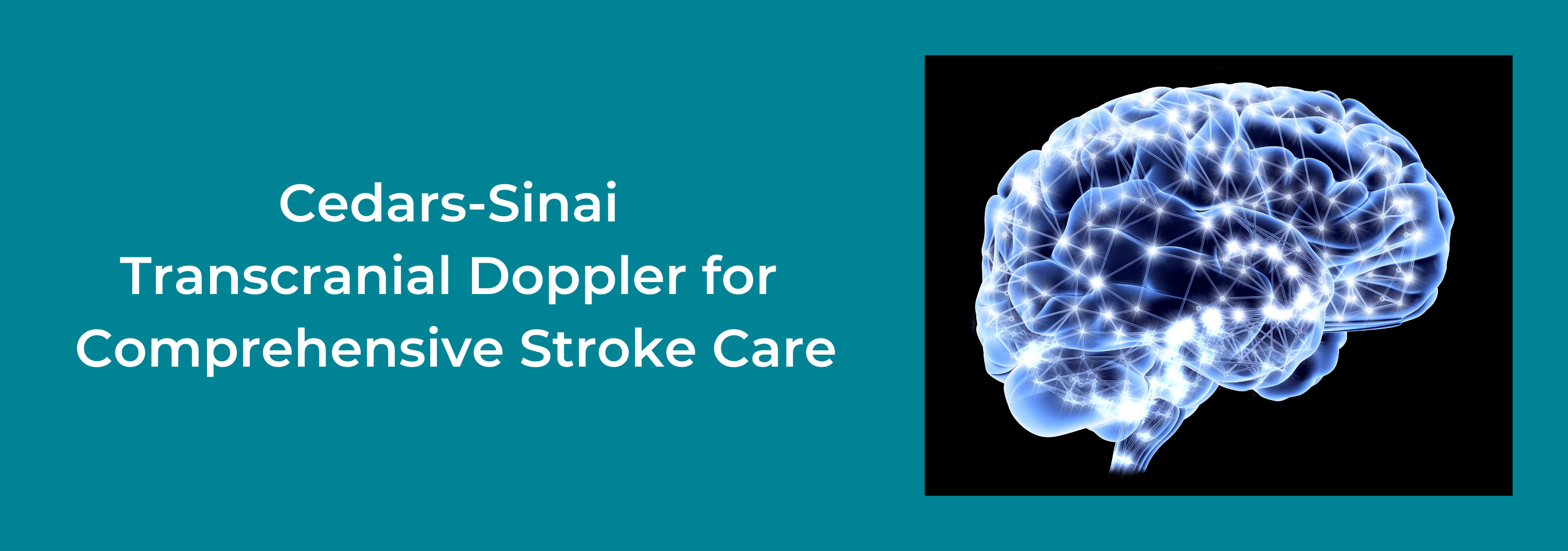 2020 March Cedars Sinai Transcranial Doppler For Comprehensive